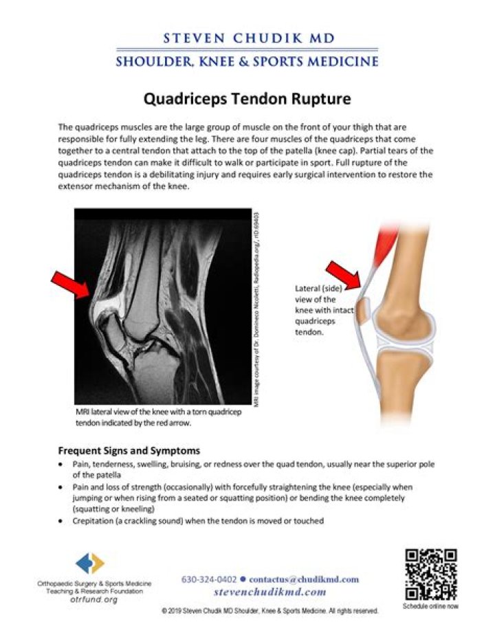 Does torn quadriceps tendon require surgery?